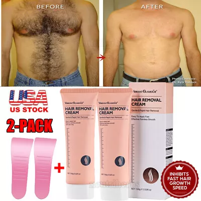 $17.28 • Buy Permanent Hair Removal Cream Painless Legs Pubic Armpit Depilatory Paste 100g
