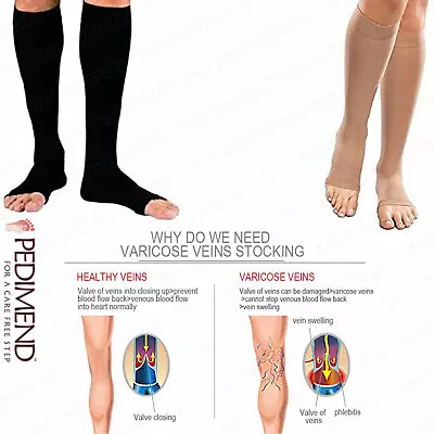 Pedimend™ Knee High Toeless Compression Stockings - Calf Compression Socks - UK • £9.98