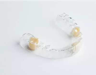 Clear Retainer Partial Denture (Essix Retainer) • $299