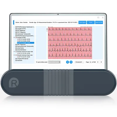 Dynamic 24hour 12 Lead ECG EKG Holter Monitor Software ​AI ECG Analysis US Ship • $269.99