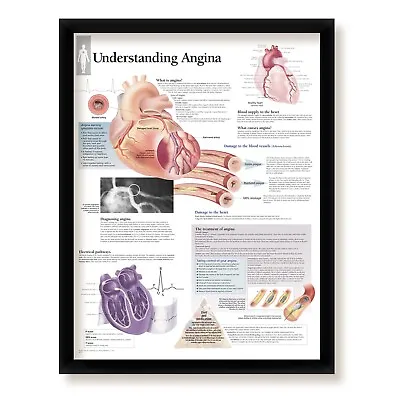 Understanding Angina Framed Medical Informational Poster 22x28 Wall Diagram • $65.99