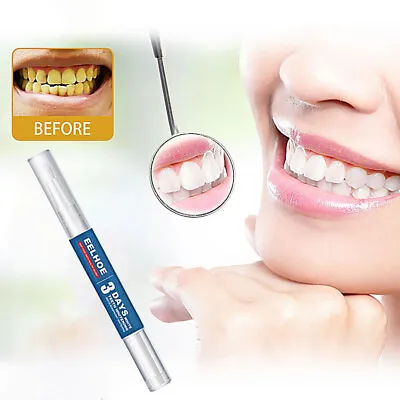 $10.99 • Buy Teeth Whitening Gel Pen Extra Strong White Tooth Whitener Stain Removal ET