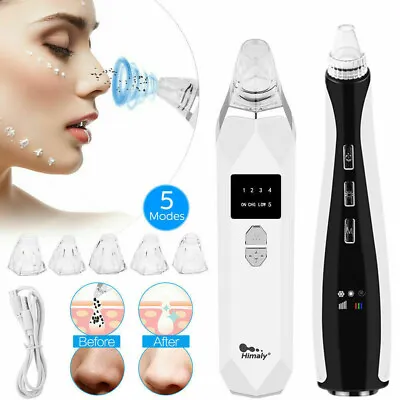 Electric Facial Skin Care Pore Blackhead Remover Cleaner Vacuum Acne Cleanser UK • £18.99