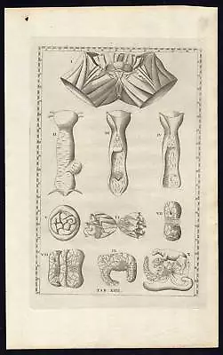 2 Antique Prints-ANATOMY-FEMALE SEXUAL ORGANS-VAGINA-Albinus-Eustachius-1761 • $197.50