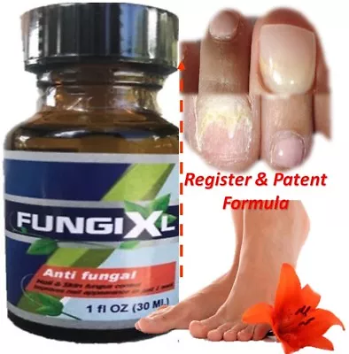 Anti-fungal Maximum Strength Toenail Fungus Athletes Foot Fungi Nail Support • $8.99