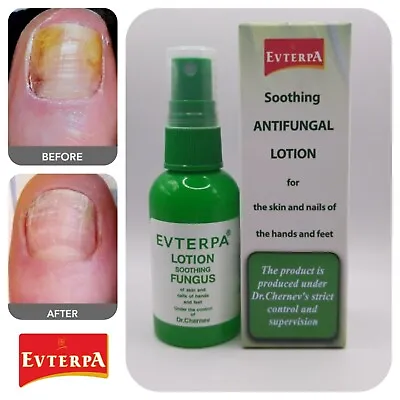 Fungal Nail Treatment Anti Fungus Foot Finger Nails Care Repair Kill 99.9% 50ml • £8.15