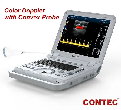 Portable Ultrasound Scanner Diagnostic Ultrasonic Machine Convex Color Doppler • £3337