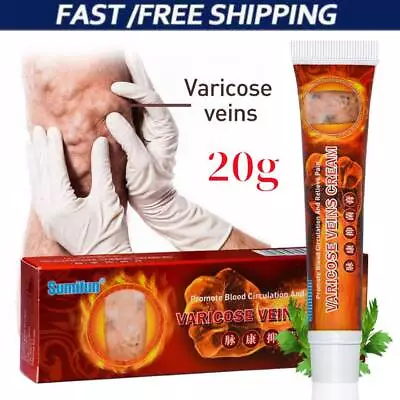 Original Vasculitis Blood Circulation Varicose Veins Treatment New Cream 20g UK • £2.59