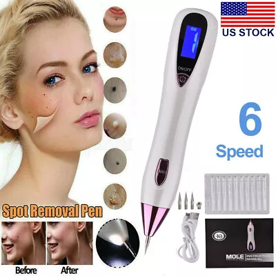 $6.95 • Buy Laser Plasma Pen Mole Removal Skin Tag Remover Sport Wart Tattoo Removal Machine