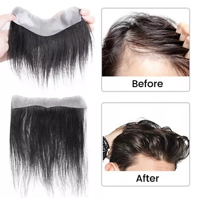 Thin 100% Human Hair Toupee For Men Forehead Topper Hairpiece Replacement System • £19.20