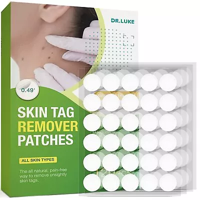 120pcs Skin Tag & Acne Patch - Hydrocolloid Acne And Skin Tag Remover Patches • $12.54