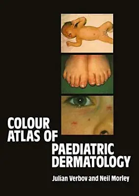 Colour Atlas Of Paediatric Dermatology By Morley W.N. Hardback Book The Cheap • £4.99