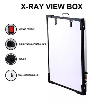 Xray Light Box View Box Viewer Led Film Screen Film Light Box X Ray Illuminator • $79