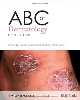 ABC Of Dermatology (ABC Series) Paperback Book The Cheap Fast Free Post • £4.99