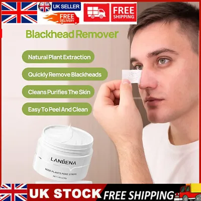 LANBENA Blackhead Remover Mask Facial Nose Mask Plant Pore Strips Acne Peel Off • £7.95