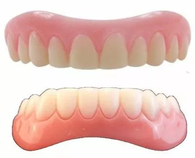 MEDIUM Instant Smile Set Uppers And Lowers 2 Extra Bags Of Thermal Beads • $25.95