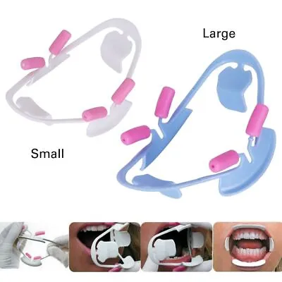 Orthodontic O Shape Mouth Opener 3D Cheek Lip Retractor Dentist • £4.29