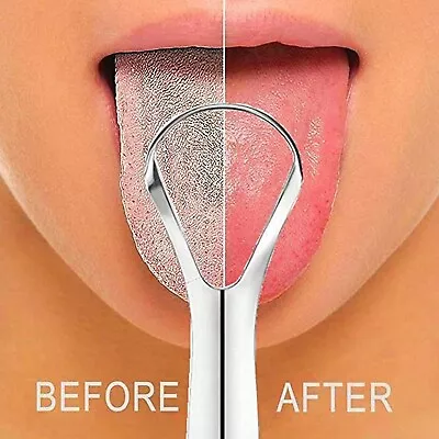 Stainless Steel Tongue Scraper Metal Tongue Cleaner Dental Care HOT NEW • $3.89