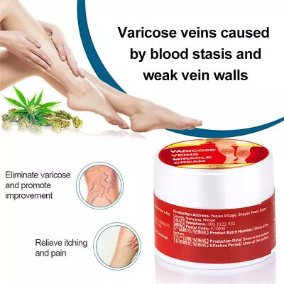 Varicose Veins Miracle Cream Vasculitis Legs Treatment External Skin Ointment • $3.49