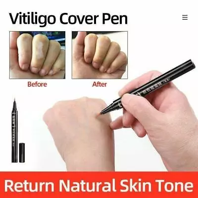 Vitiligo Cover Pen Scars Birthmarks Waterproof White Spots Camouflage Makeup New • $10.86