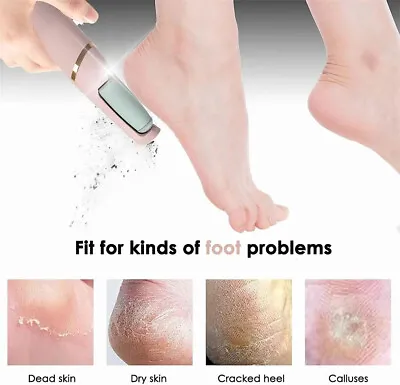 Rechargeable Electric Foot Grinder File Removes Dry Coarse Dead Skin Remover • £5.49