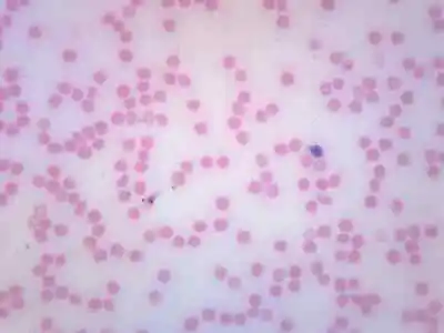 25PK Human Blood Smear - Prepared Microscope Slides 75x25mm - Eisco Labs • $37.99