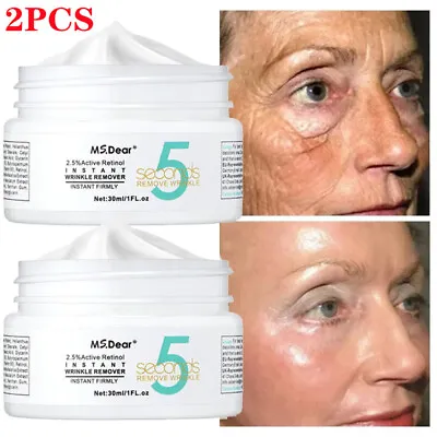 2PC 5 Seconds Wrinkle Remove Instant Face Cream Skin Tightening Anti-Aging Serum • £8.45