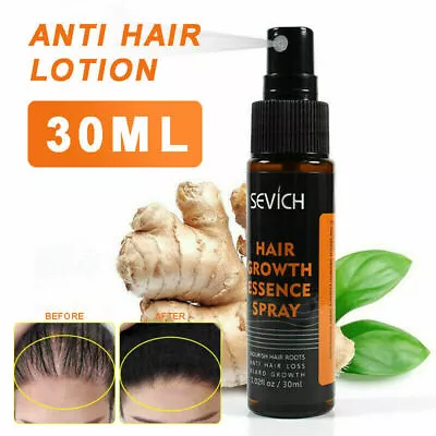 LIPowerful Hair Growth Essential Oil Hair Loss Treatment Nourishing Care • £6.99