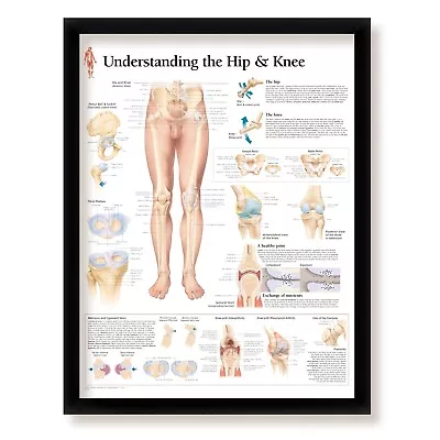 Medical Poster Understanding The Hip & Knee Poster 22x28 Wall Diagram • $65.99