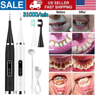$8.45 • Buy Ultrasonic Electric Tooth Cleaner Plaque Stains Remover Teeth Whitening Gel Pen