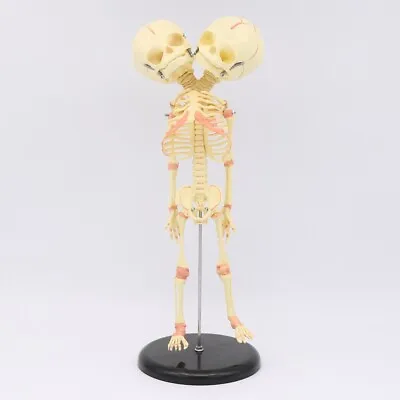 35cm Human Double Head Baby Anatomy Education Skull Skeleton Study School • £65.99