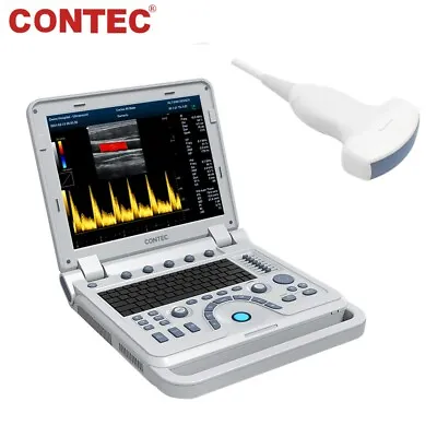 £3337 • Buy Portable Laptop Ultrasound Scanner Color Doppler Ultrasound Machine Convex Probe
