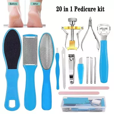 Foot Rasp File Pedicure Callus Remover Hard Dead Skin Scrubber Tool Feet Care • $10.99