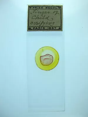 Antique Microscope Slide By A.C.Cole.  Finger Of Child Ossifying . • $6.22
