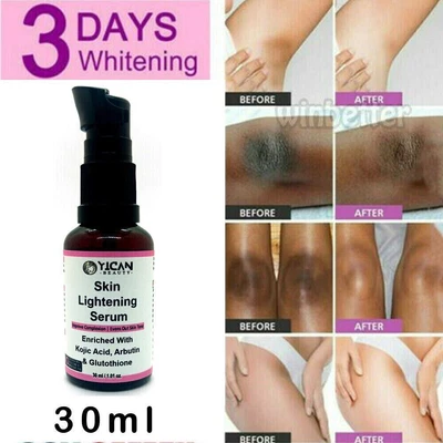 $29.67 • Buy Strong Whitening Serum Essential Oil For Removing Dark Knuckle Finger Elbow Knee