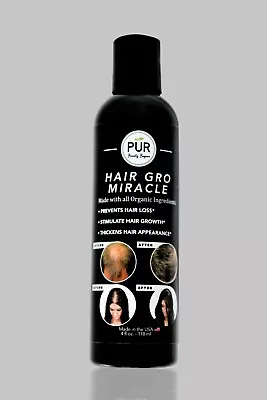 Hair Gro Miracle Oil   • $18