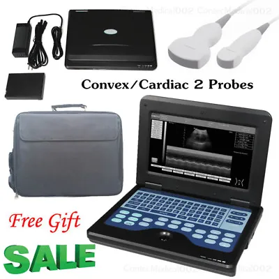 £1557 • Buy Portable Ultrasound Scanner Laptop Machine 2 Probes Convex+Micro Convex 2 Probes