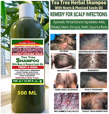 Fast Remedy  Itchy Scalp Fungus & Skin Infection Tea Tree Herbal Shampoo 500 ML • £13