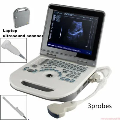 Portable Laptop Digital Ultrasound Scanner + Convex / Transvaginal /Linear Probe • $399