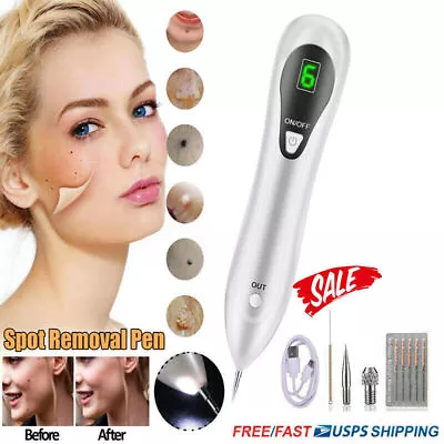 LCD Laser Plasma Pen Mole Removal Dark Spot Remover Skin Wart Tag Tattoo • $11.81