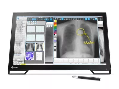 Eizo Radiforce MS236WT-A 2MP 23  Multi-Touch Color Clinical Review LCD Monitor • $1000