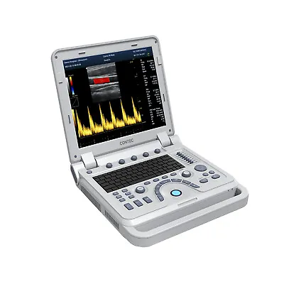 £5072 • Buy Portable Colour Ultrasound Scanner With 3.5M Convex Probe Digital Laptop Machine
