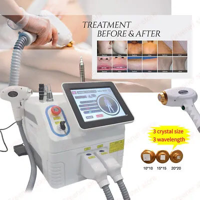 2IN1 808nm 1064nm 755nm Diode Laser Hair Removal Tattoo Pico IPL ND Yag Machine • $1488