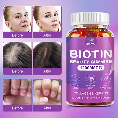 Biotin Collagen Vitamin Gummies For Hair Skin Nails Premium Collagen Supplement • $11.73