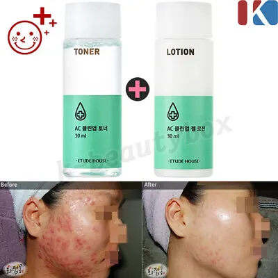 Acne Control Clean Up Skin Care Toner Emulsion Blemish Acne Skin Damaged Skin • $12.82