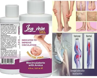 Cream Gel Thread Spider Varicose Veins Scars Rosacea Capillaries Venas Varices • $12.97