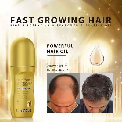 50ML Vitamin B7 Fast Hair Growth Serum Organic Hair Loss Treatment For Men Women • £7.99