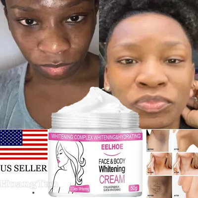 $10.95 • Buy 3 Days Skin Dark Spot Remover For Face,Whitening Lightening Brightening Cream US