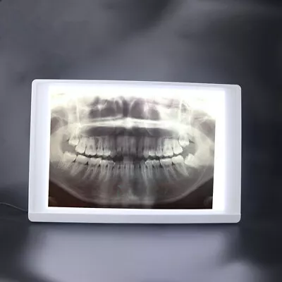 Dental LED X-Ray Film Viewer Panoramic Negatoscope LED Illuminator View Box • $85.49