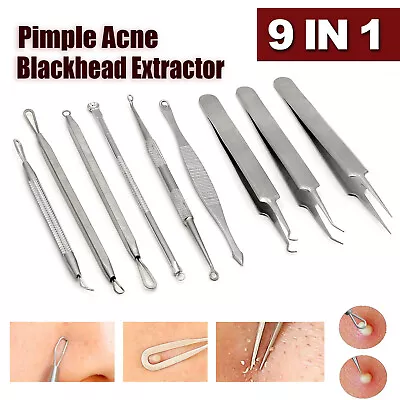 $6.99 • Buy 9pcs Set Blackhead Extractor Tool Remover Pimple Blemish Comedone Kit Acne Clip